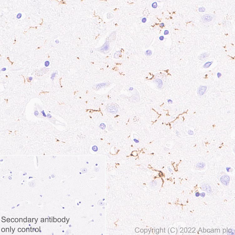 Anti-P2Y12 antibody [EPR26298-93](AB300140)