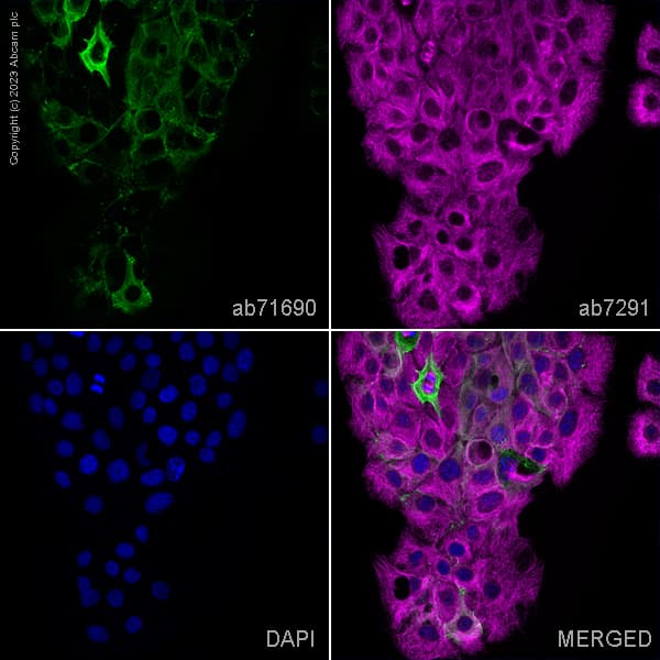 Desmoplakin Iii Antibody Ab71690  Immunocytochemistry Immunofluorescence Img425096