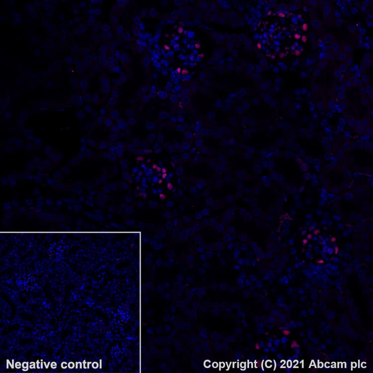 Alexa Fluor® 647 Anti-Wilms Tumor Protein antibody [EPR23963-116](AB283325)