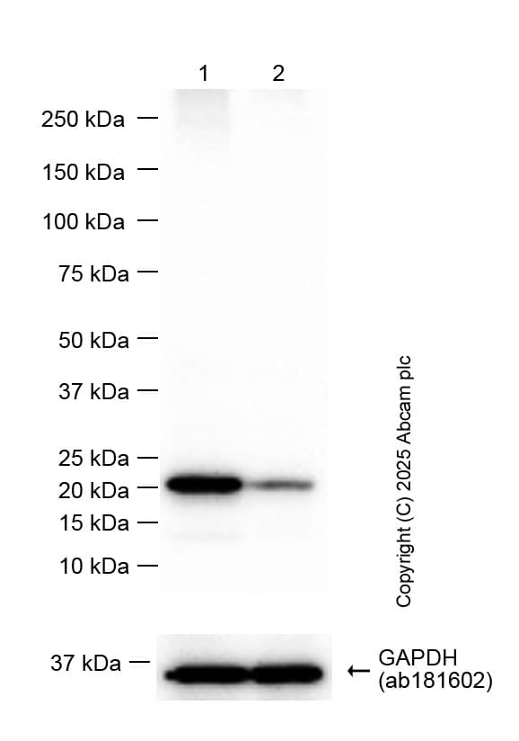 Anti-Ferritin heavy chain antibody [EPR3004Y](ab75973)