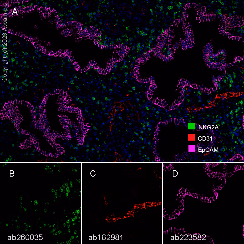Fluorescence multiplex immunohistochemical analysis of human endometrium showing expression of EpCAM, NKG2A, and CD31.