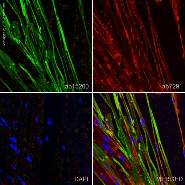 Anti-Desmin antibody - Cytoskeleton Marker(AB15200)