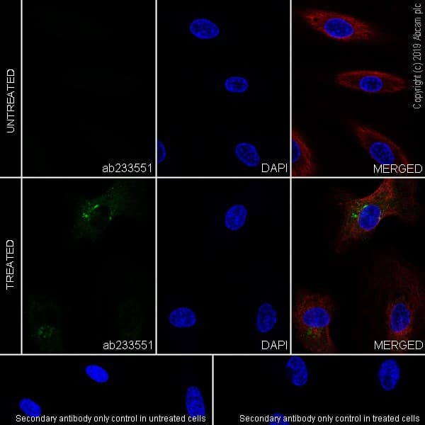 Il 6 Antibody Epr22565 204 Bsa And Azide Free Ab256355  Immunocytochemistry Immunofluorescence Img81607