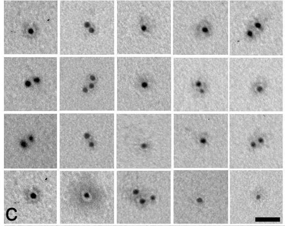 Electron microscopy image of biotinylated recombinant WARP protein (conjugated with Biotinylation kit) visualized by gold-labeled streptavidin. Scale bar: 25 nm.