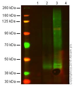 Anti-CXCR4 antibody [EPUMBR3](AB181020)