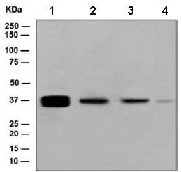 Anti-Cytokeratin 19 antibody [EPNCIR127B](AB133496)