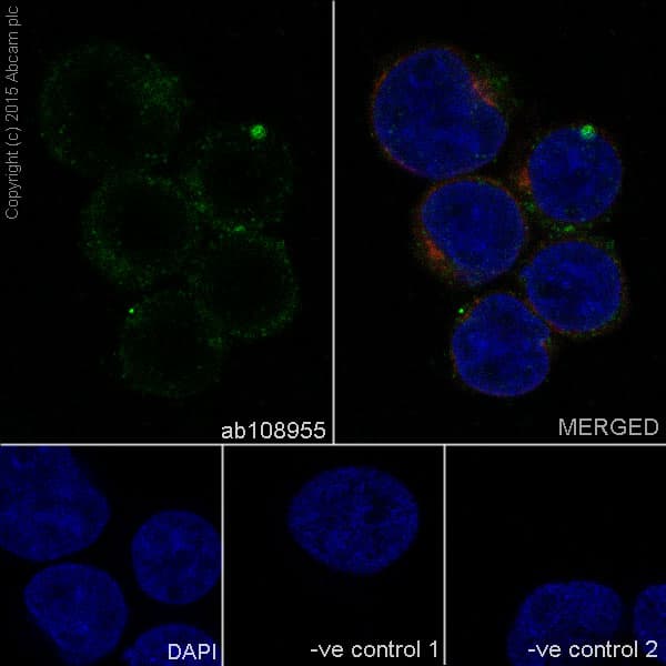 Il 2 Receptor Alpha Antibody Epr6452 Ab128955  Immunocytochemistry Immunofluorescence Img13271