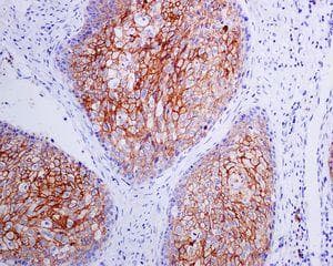 Anti-Syndecan-1 antibody [EPR6454](AB128936)