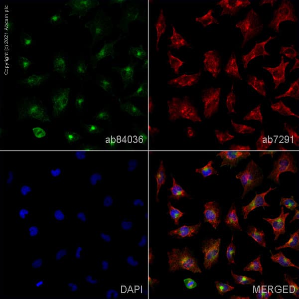 Anti-Transferrin Receptor antibody(ab84036)