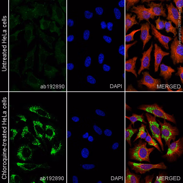 ab192890 staining LC3B in HeLa (Human epithelial cell line from cervix adenocarcinoma) cells +/- Chloroquine (50 μm, 24 hours).