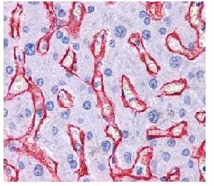 Paraffin-embedded human liver tissue stained for Collagen IV using ab6586 at 1/400 dilution in immunohistochemical analysis, strong staining was observed in the sinusoids.