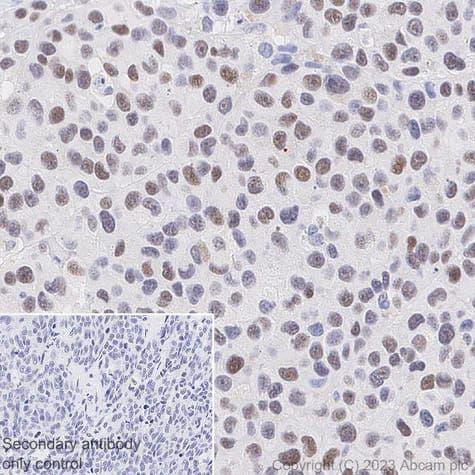 Immunohistochemistry (Formalin/PFA-fixed paraffin-embedded sections) - Anti-PRAME antibody [EPR20330] (ab219650)