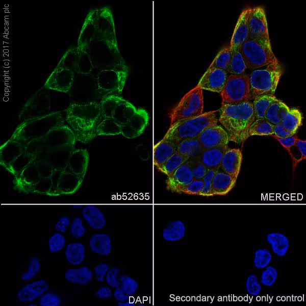Immunofluorescence image of A431 cells stained for Cytokeratin 6 (green), alpha-Tubulin (red), and nuclei (blue).
