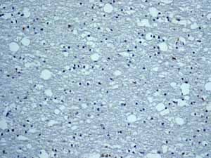 Cytochrome P450 4a Cyp4a11 Antibody Epr8276 Bsa And Azide Free Ab248918  Immunohistochemistry Formalin Pfa Fixed Paraffin Embedded Sections Img134932