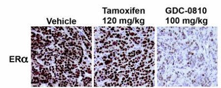 Immunohistochemical staining of estrogen receptor alpha in tamoxifen-resistant MCF7 xenograft tumors.