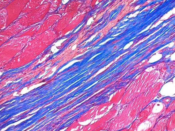 Trichrome stain of human muscle tissue