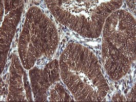 Anti-Von Hippel Lindau/VHL antibody [OTI1E1] - BSA and Azide free(AB273655)