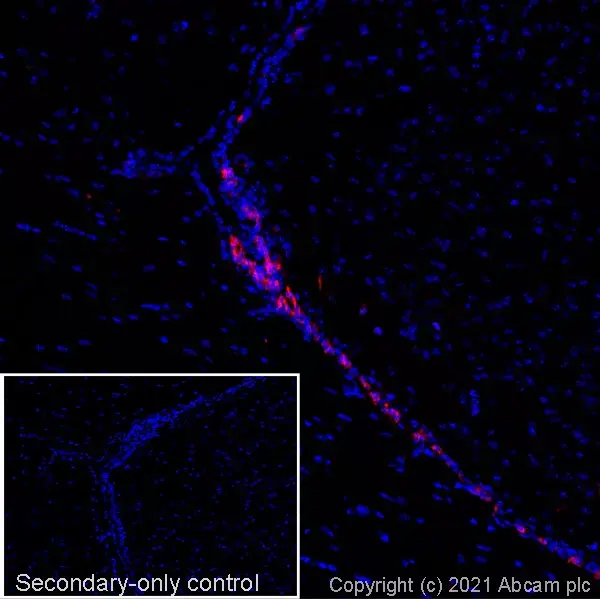 Anti-Doublecortin antibody(AB18723)