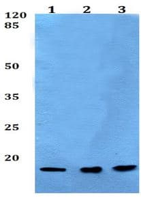 Polr2i Antibody Ab192407  Western Blot Img106089