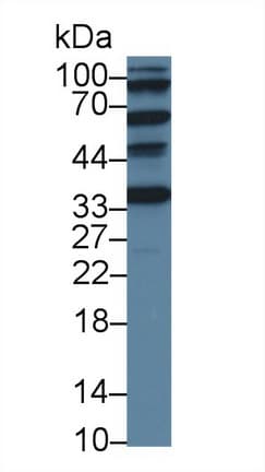 Anti-ACD antibody(AB231330)