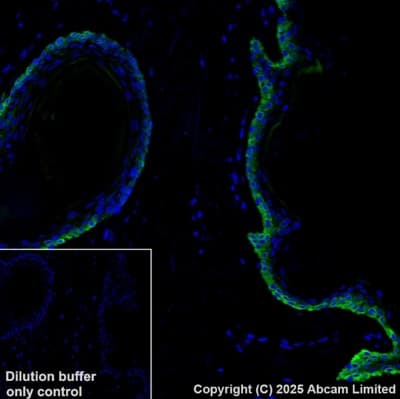Alexa Fluor® 488 Anti-Cytokeratin 14 antibody [EP1612Y](AB192055)
