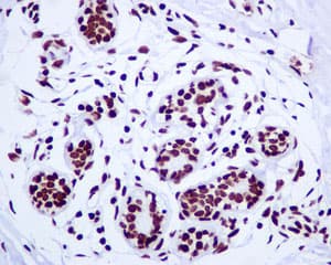 Anti-Histone H2A.Z antibody [EPR6172] - ChIP Grade(AB124793)