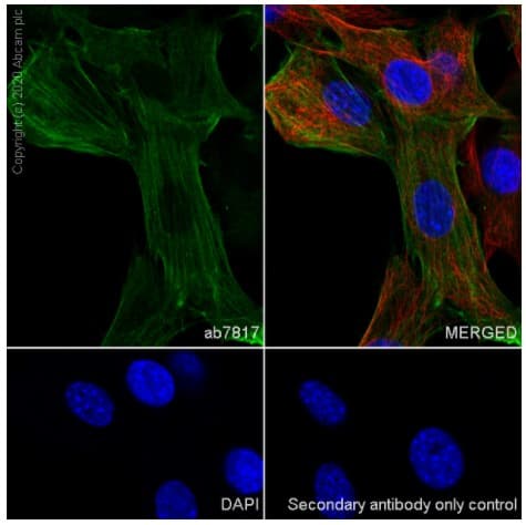 Anti-alpha smooth muscle Actin antibody [1A4] - BSA and Azide free(AB240654)