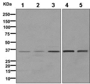 Ppp2cb Antibody Epr11786b Bsa And Azide Free Ab249465  Western Blot Img107271