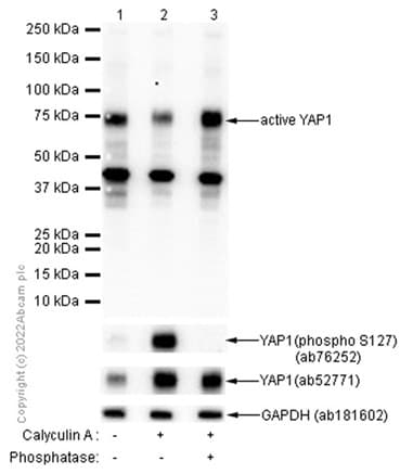 Anti-active YAP1 antibody [EPR19812](AB205270)