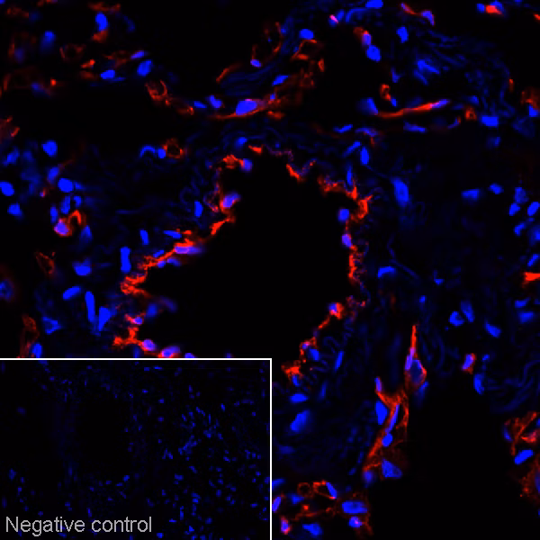 IHC image of ab9498 staining in 10% formaldehyde fixed frozen tissue section of human lung.