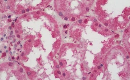 Anti-ATP6V0C antibody(AB230323)