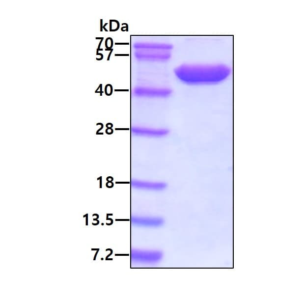 Recombinant Human NSE protein(ab78797)
