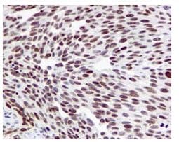 Anti-Histone H4 (acetyl K16) antibody [EPR1004] - BSA and Azide free(AB194352)