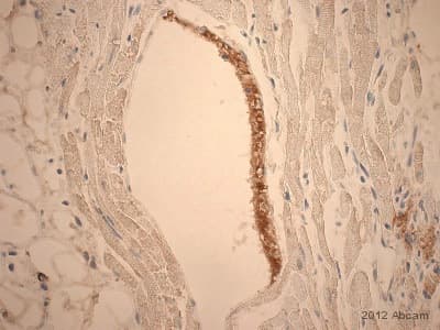 Anti-Fibrinogen antibody(AB34269)