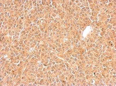 Ggps1 Antibody Ab155584  Immunohistochemistry Formalin Pfa Fixed Paraffin Embedded Sections Img70280