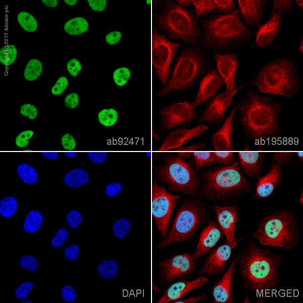 Anti-MSH6 antibody [EPR3945](AB92471)
