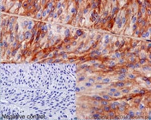 Anti-HAI-1 antibody [EPR15652](AB189511)