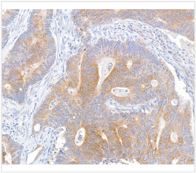 Anti-MACC1 antibody [BLR135H] - BSA free(AB314047)