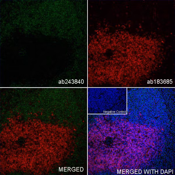 Immunohistochemistry (frozen sections) - anti-CD4 antibody [EPR19514] (ab183685). IHC image of CD4 staining in a section of frozen normal mouse spleen.
