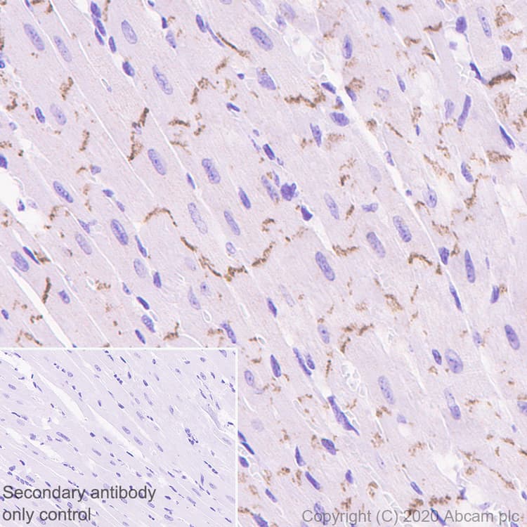 Anti-pan Cadherin antibody [EPR1792Y] - Intercellular Junction Marker(AB51034)
