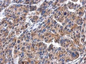Anti-GBA antibody(AB96256)