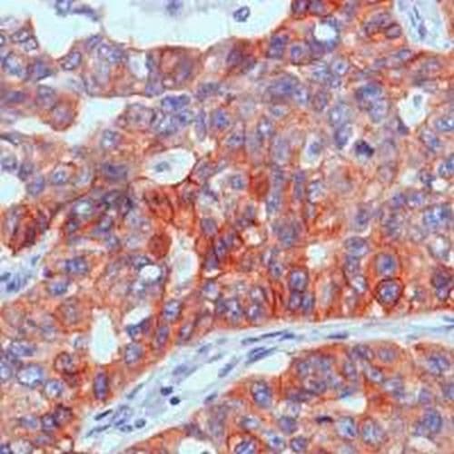 Egfr Antibody Sp84 Bsa And Azide Free Ab238803  Immunohistochemistry Formalin Pfa Fixed Paraffin Embedded Sections Img133963