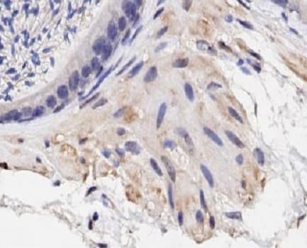 Anti-Collagen IV antibody(AB235296)