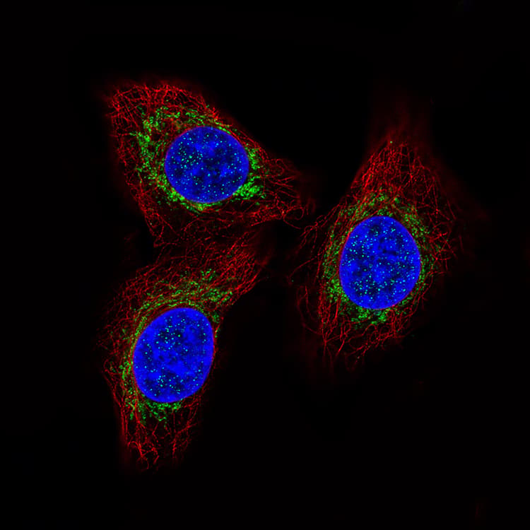 Mcu Antibody Cl3576 Ab219827  Immunocytochemistry Img6273