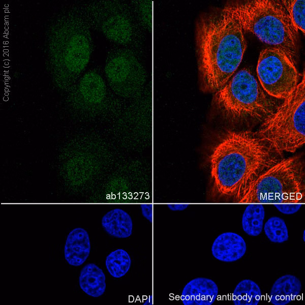 Immunocytochemistry/Immunofluorescence analysis of MCF7 cells labeling Androgen receptor, alpha Tubulin, and DAPI.