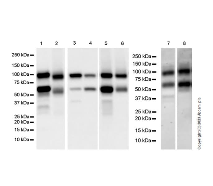 Complement Factor B Antibody Epr27443 6 Bsa And Azide Free Ab309150  Western Blot Img409470