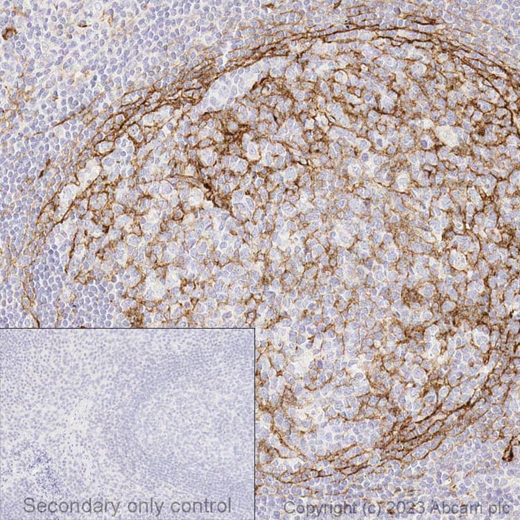 Anti-CD14 antibody [SP192](AB183322)