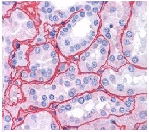 Paraffin-embedded human kidney tissue stained for Collagen IV using ab6586 at 1/400 dilution in immunohistochemical analysis with strong staining observed in glomeruli.