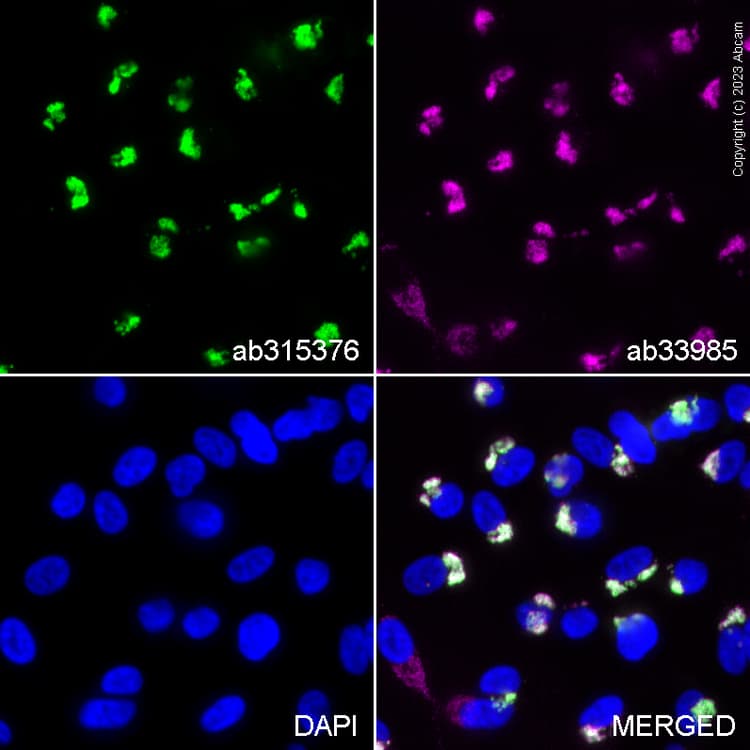 Goat Anti-Rabbit IgG H&L (Alexa Fluor® 647) preadsorbed(AB150083)