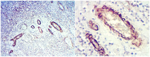 Immunohistochemistry (Formalin/PFA-fixed paraffin-embedded sections) analysis of human tonsil tissue labelling alpha smooth muscle Actin with ab5694 at a dilution of 1/1000.